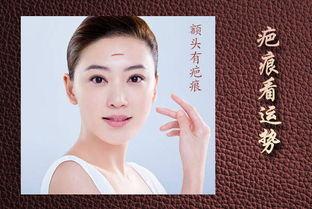 额头有疤的明星网红,揭秘额头有疤的明星网红