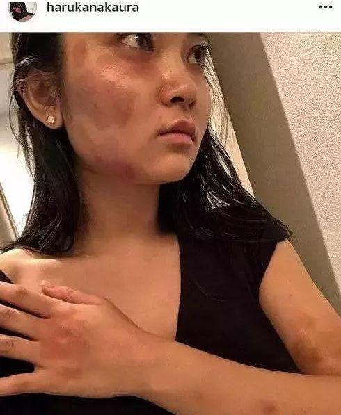 吃瓜网热门事件今日吃瓜,吃瓜网热门事件，揭秘娱乐圈最新八卦风云